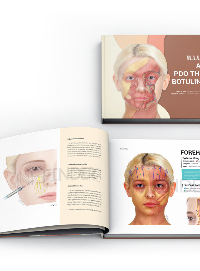 Illustrated atlas for PDO thread and Botulinum toxin