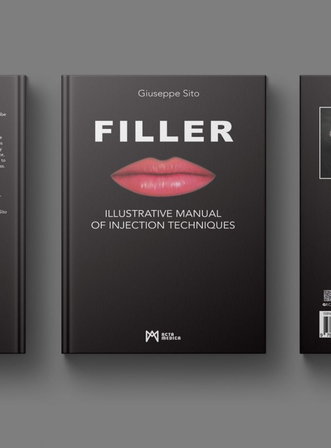 Filler - Illustrative Manual of Injection Techniques